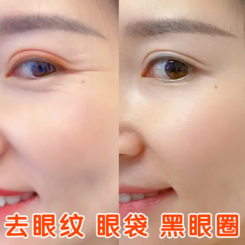 超音波ナイフアイクリーム、しわ防止、小じわの軽減、目袋、クマ、脂肪粒子、目尻のしわの除去、しわ防止引き締めアイクリーム|undefined
