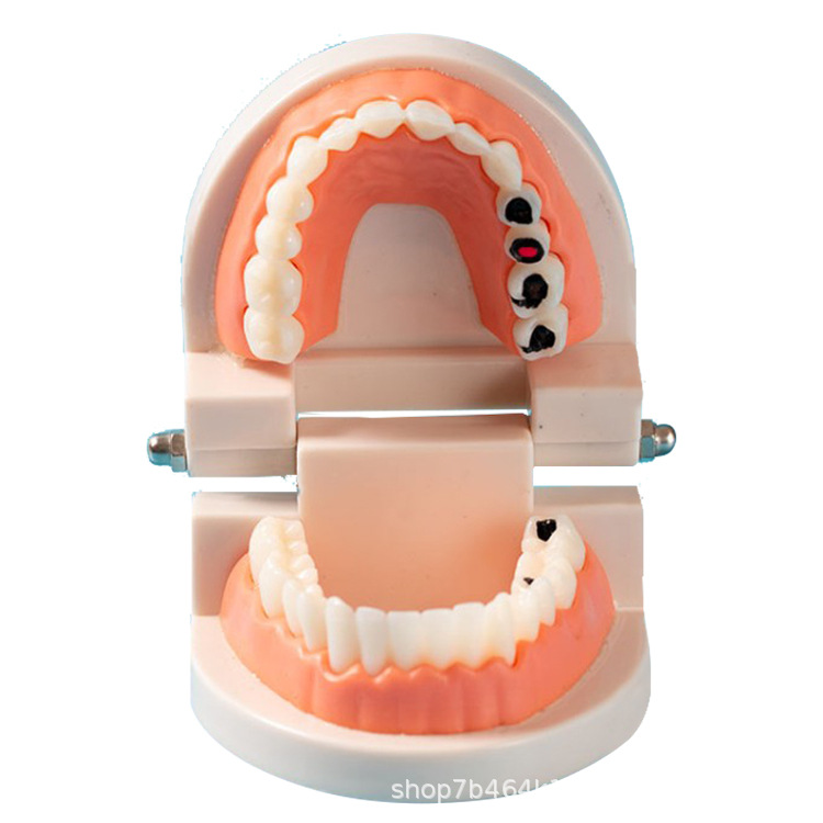 Modelo dental molde modelo dental modelo de enseñanza dental removible dentadura oral cepillado Preparación del diente modelo resina