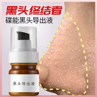 黑头导出液美容院专用收缩毛孔去粉刺闭口院装去黑头产品导出液