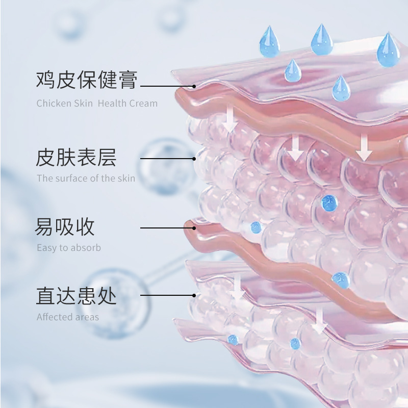 Qimei Jiukuan 魚鱗鶏皮スキンヘルスケアクリーム乾燥肌の皮むけと皮むけを和らげる魚鱗クリーム卸売|undefined