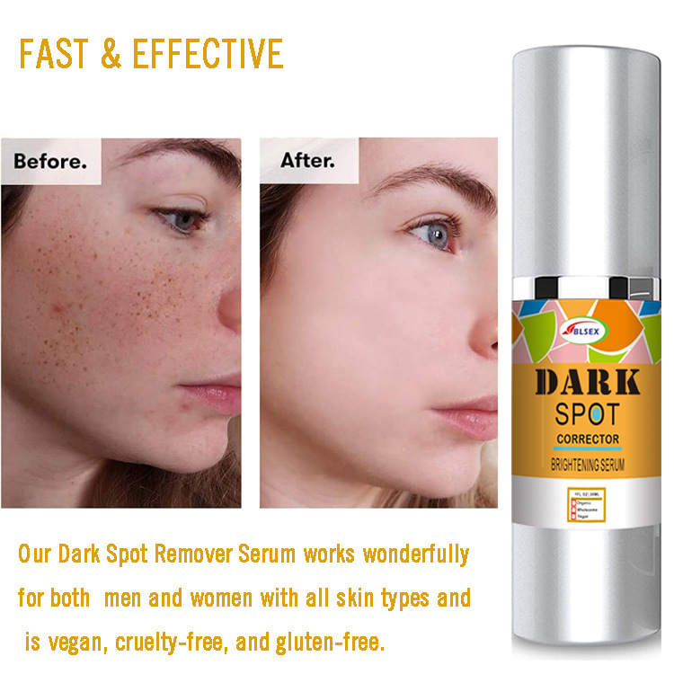 BLESEX Face essence Melanin Black Spot Skin Care Anti Freckle Serum 30ml_voghion.com