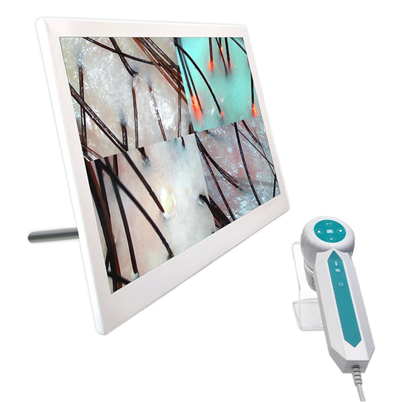 Instrumento de detección de cuero cabelludo pérdida de cabello folículo 3 espectro HD analizador peluquería salón de belleza instrumento de prueba de la piel