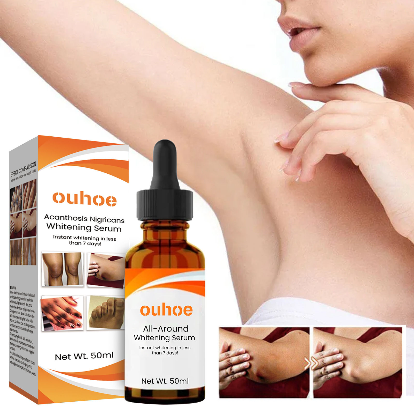 OUHOE acanthus whitening underarm elbow knee joint black brightening skin beauty essence_voghion.com