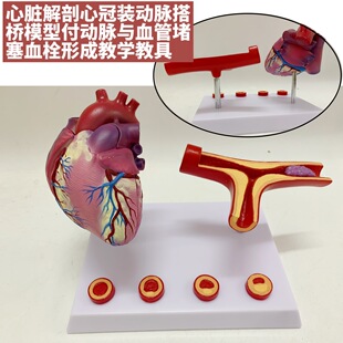 Cardiac anatomy coronary artery bypass model arterial and vascular blockage thrombosis teaching aids