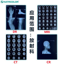 干式胶片放射科低温热敏胶片CT/DR虎丘富士乐凯打印机耗材工厂