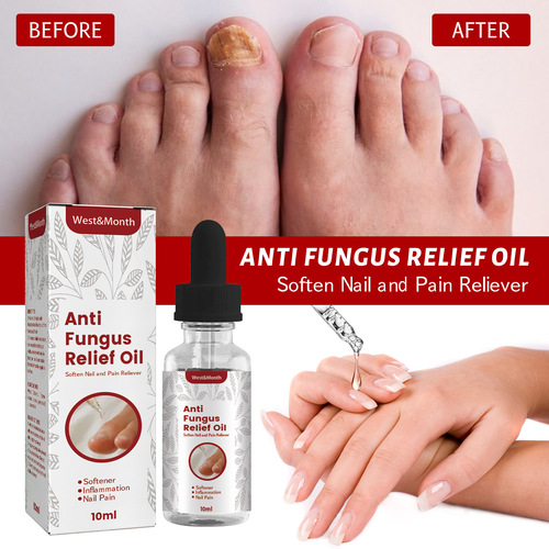 West&Month Onychomycosis Repair Solution, Hand and Foot Brightening Nails, Soft Nails, Rotten Toenails, Thickening, Nourishing Nails, Moisturizing Manicure