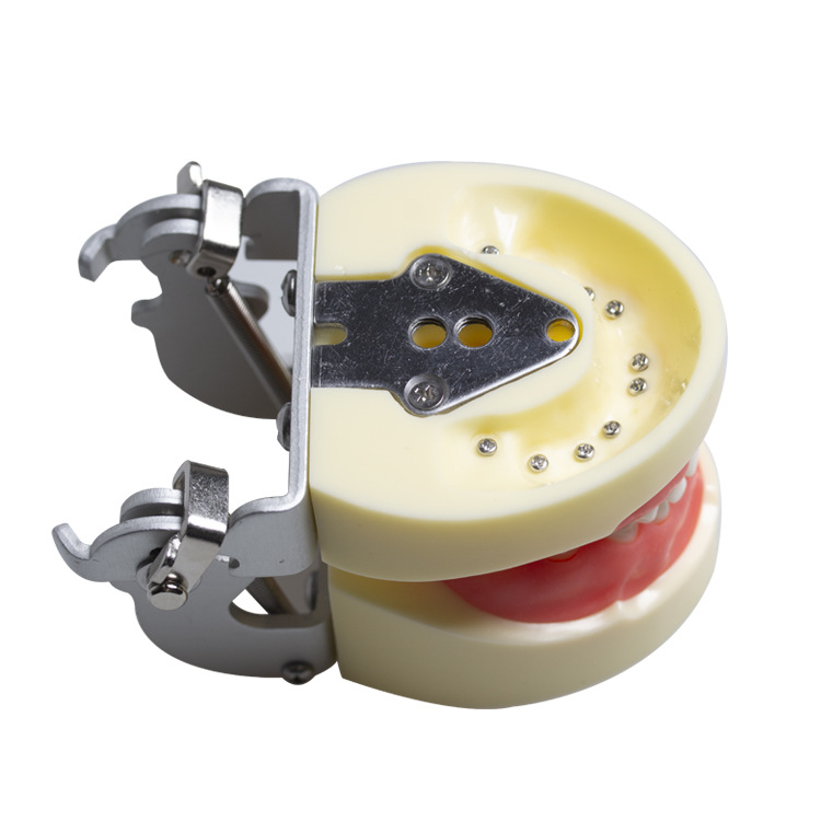 Modelo de diente deciduo para niños Modelo de caries dental extraíble Modelo de caries dental para niños Modelo dental de demostración de enseñanza oral