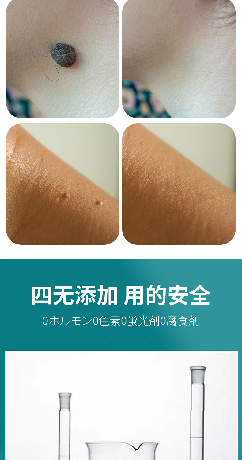 刺猴鸡眼膏去猴子肉粒疙瘩鱼鳞痣药祛疣瘊子脖子上长的小肉粒-阿里巴巴