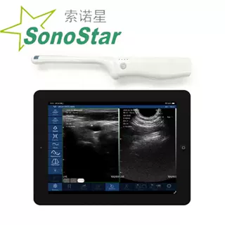 Sonostar biplane rectal palm doppler ultrasound scanner