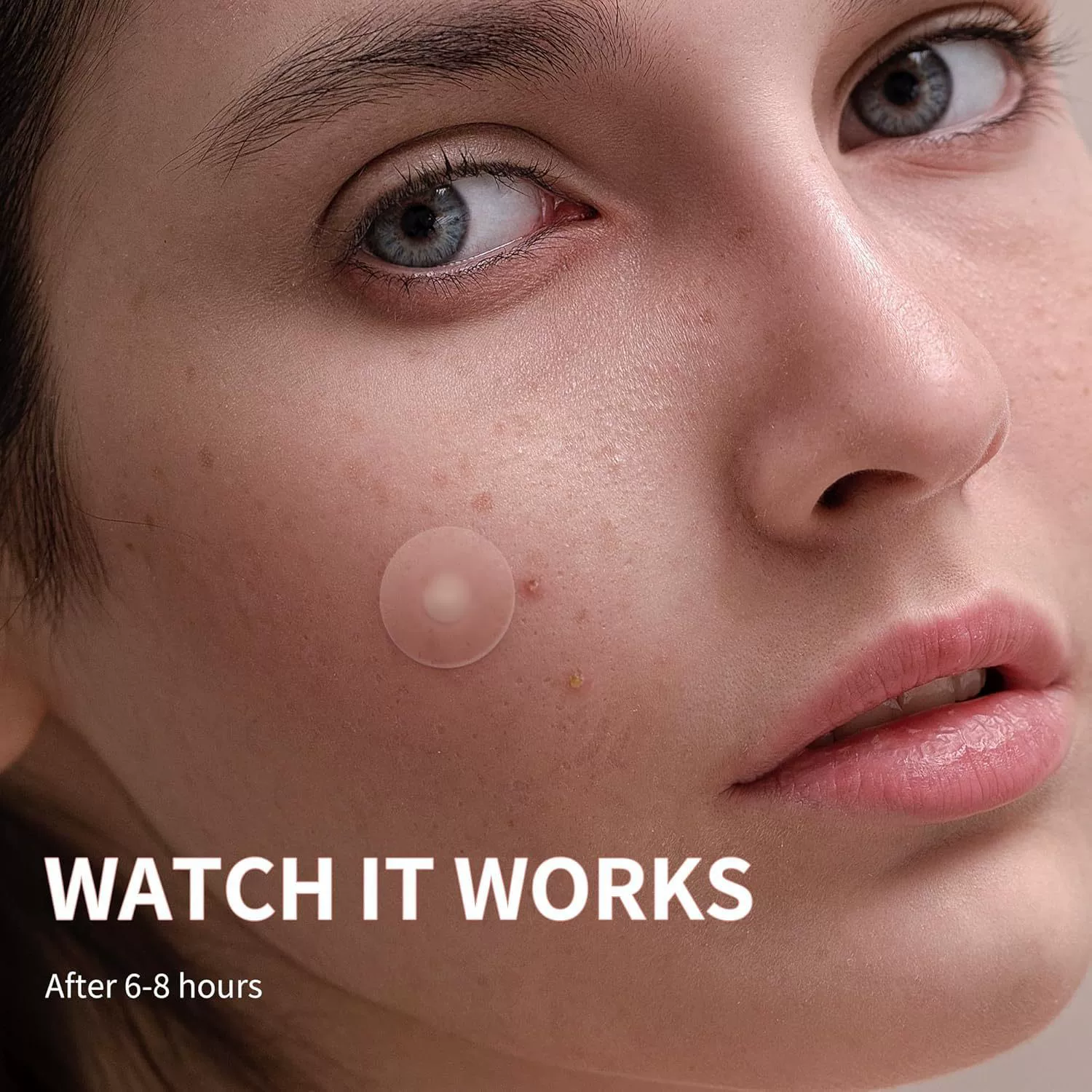 Смягчающая отбеливающая acne-патч от черных пятен, скрывает прыщи
