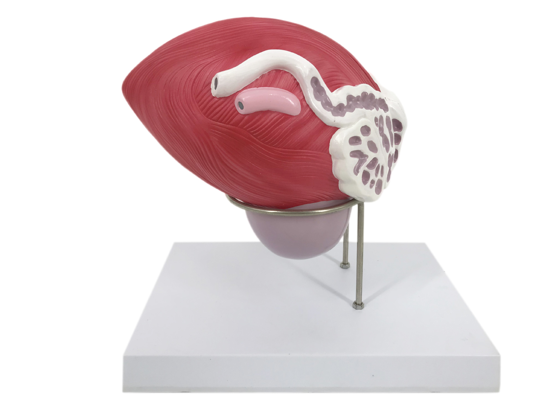 U033 Bladder Prostatic Disposal Model