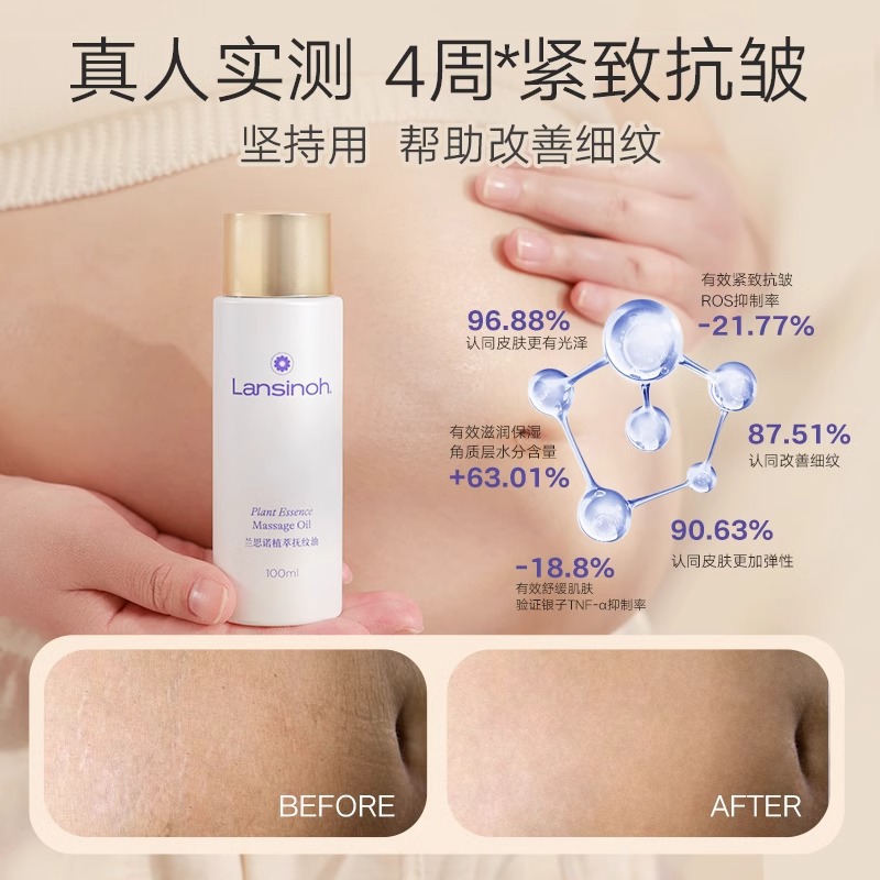 Lansinoh兰思诺妊娠纹油孕妇专用有效淡纹皮肤屏障孕期肚纹妊娠油