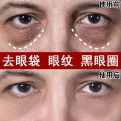 しわを取り除き、引き締めるアイクリーム、小じわや脂肪粒子を薄くする卸売しわ防止、超音波アイクリーム、目袋やクマを取り除く