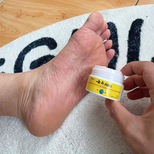 Yunnan Fungi King Athlete's Foot Home Remedy Cream Athlete's Foot Blister Peeling Cream External Use Cream Wholesale Delivery