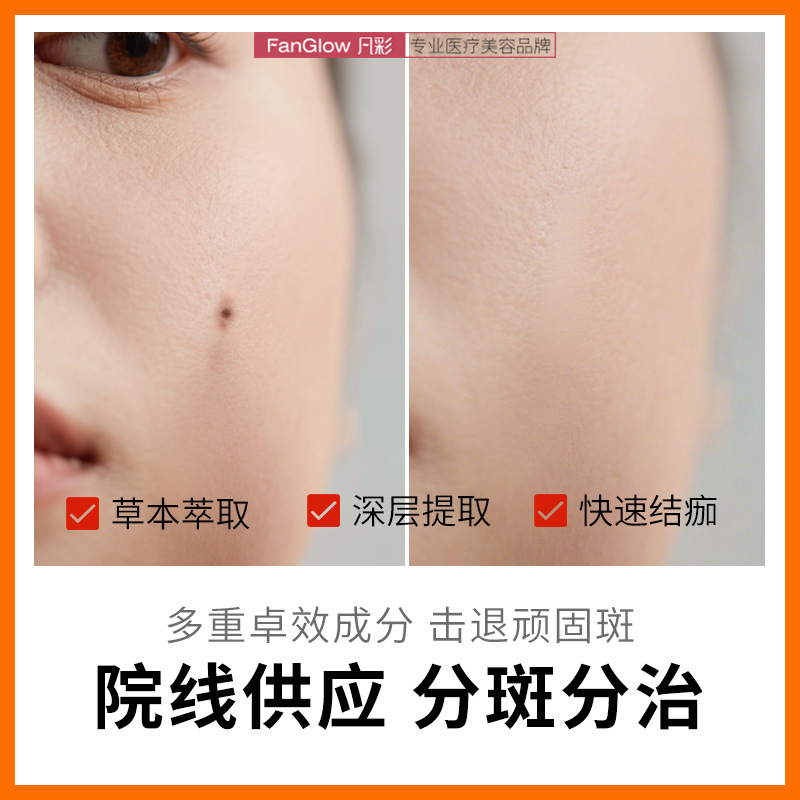 凡彩无痛提取液雀斑真皮斑提取液色素分解液点斑水点痣美容院专供|undefined