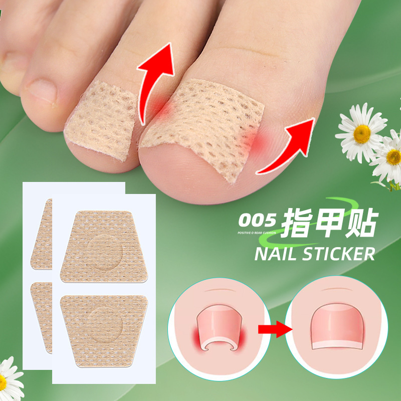 Nail care patch inlay nail groove long toe pad orthopedic stickers soft nail gray nail stickers