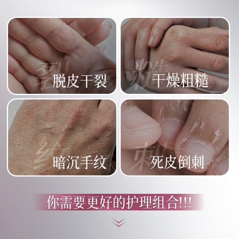 Filipino Super Model Hand Cuadric Hand Mask Hand Essence, crema para manos firme, aceite para manos hidratante, brillante y fino.
