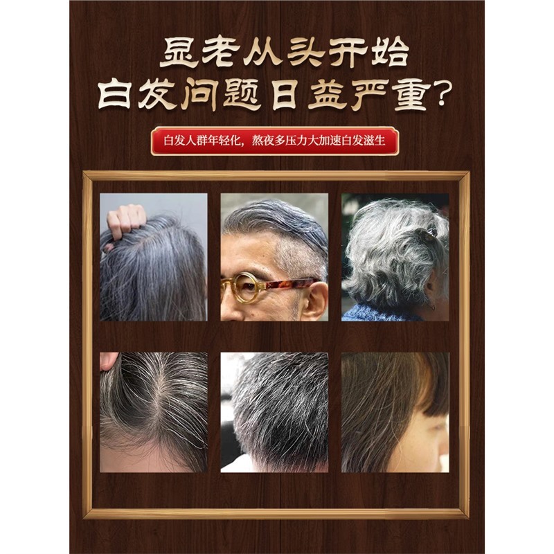 非遗传承手工何首乌中药材生发养发黑发头部按摩梳子合香梳经络梳|undefined