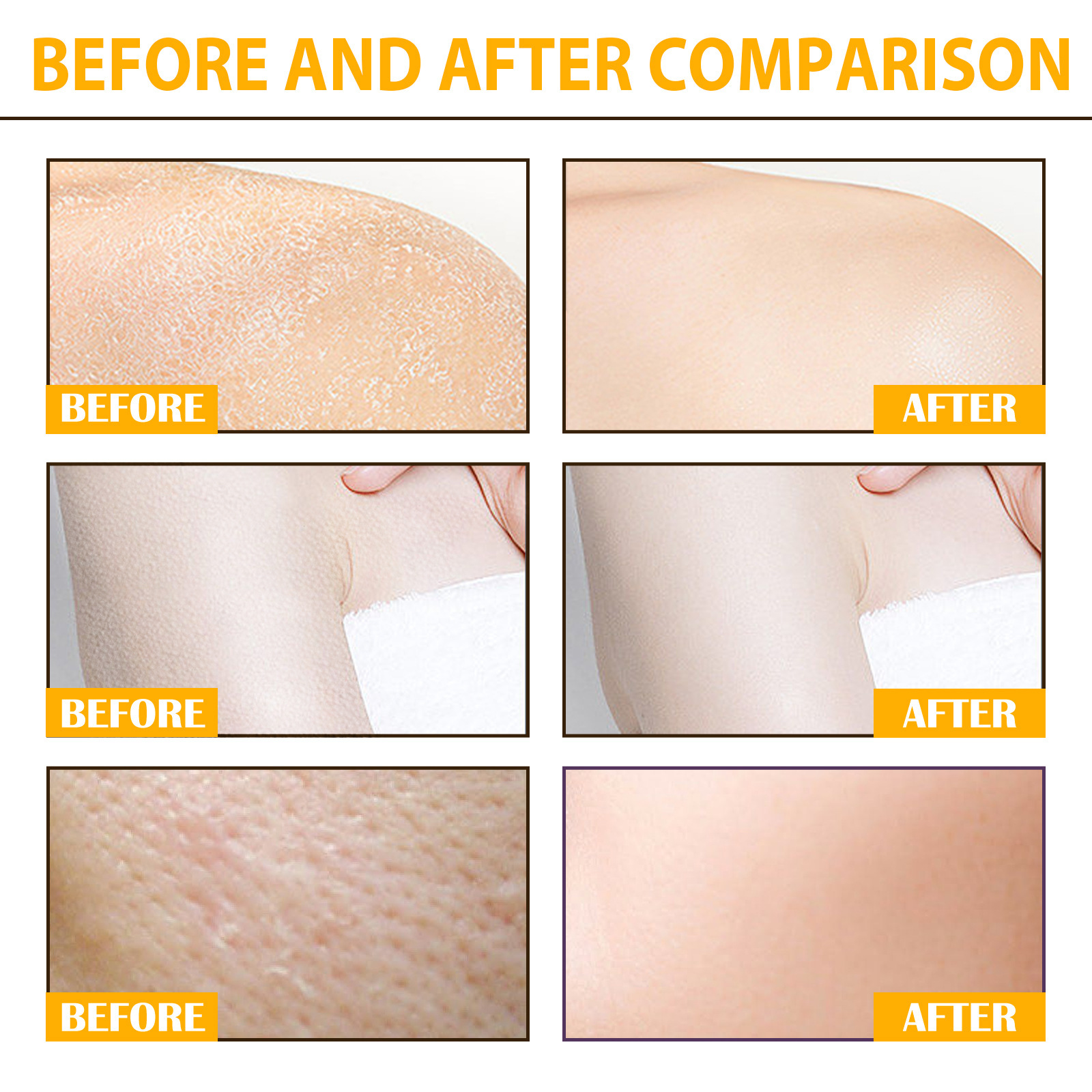 Eelhoe scrub for deep cleansing, exfoliation, dead hydration, whitening, and tender skin care_voghion.com