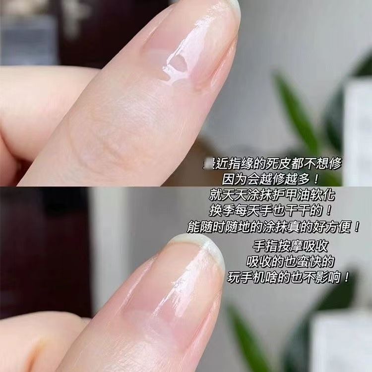 mini护甲油营养液美甲营养油女防断裂倒刺指甲边缘护理指缘油滚珠|undefined