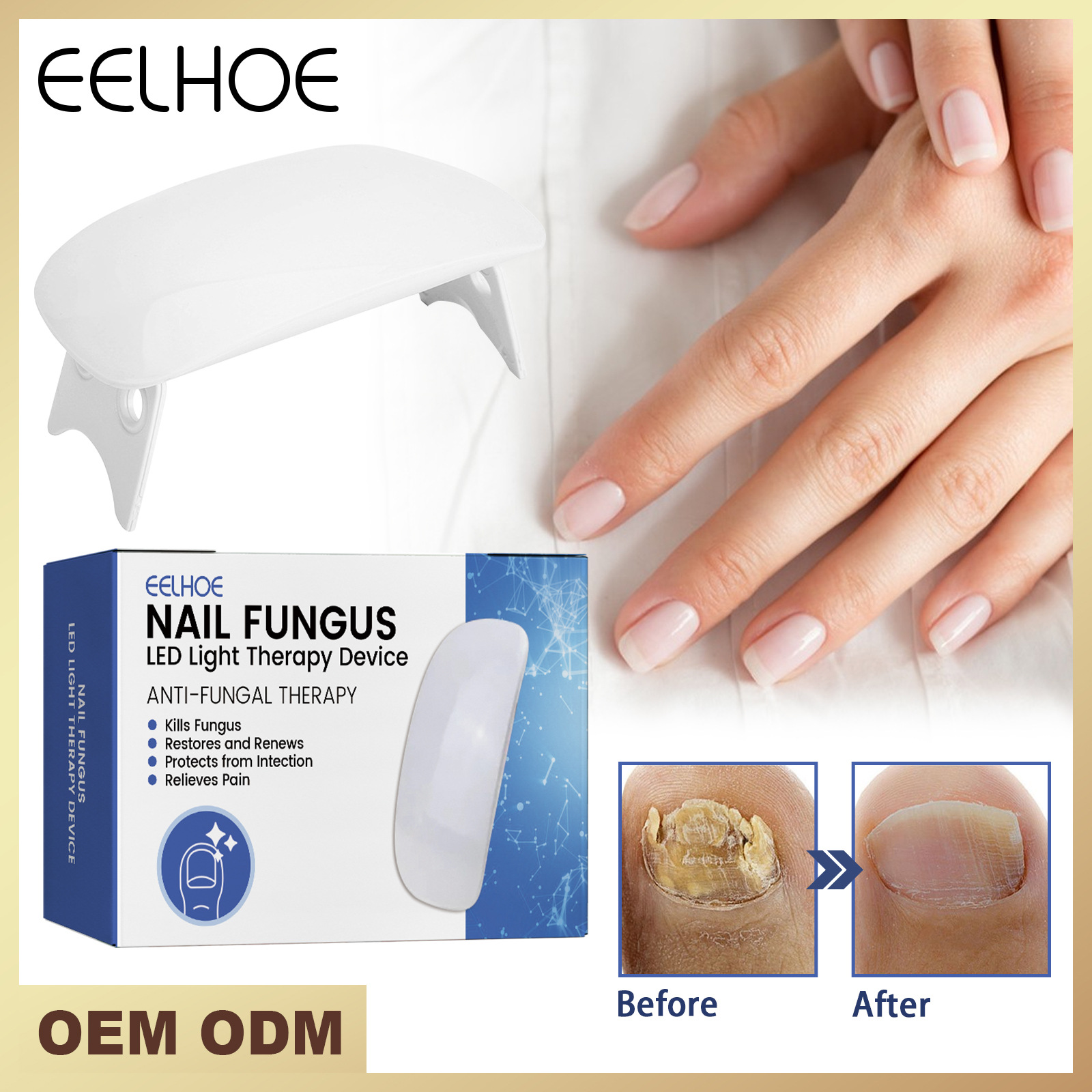 EELHOE repair LED phototherapy instrument for hand foot nails yellowing, soft repair, thickening, and smoothing of the_voghion.com