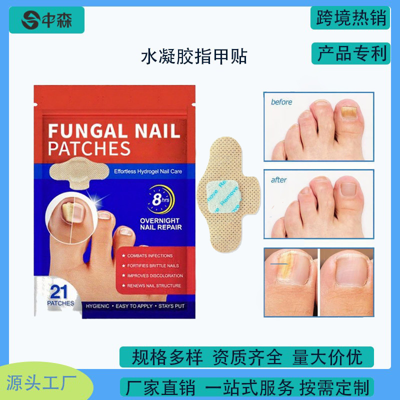 厂家定制跨境灰指甲护理贴 脚趾甲沟矫正贴片 指甲专用修护贴