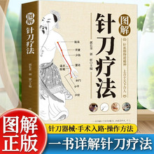 图解针刀疗法中中医适宜技术操作入门丛书医针刀疗法书籍