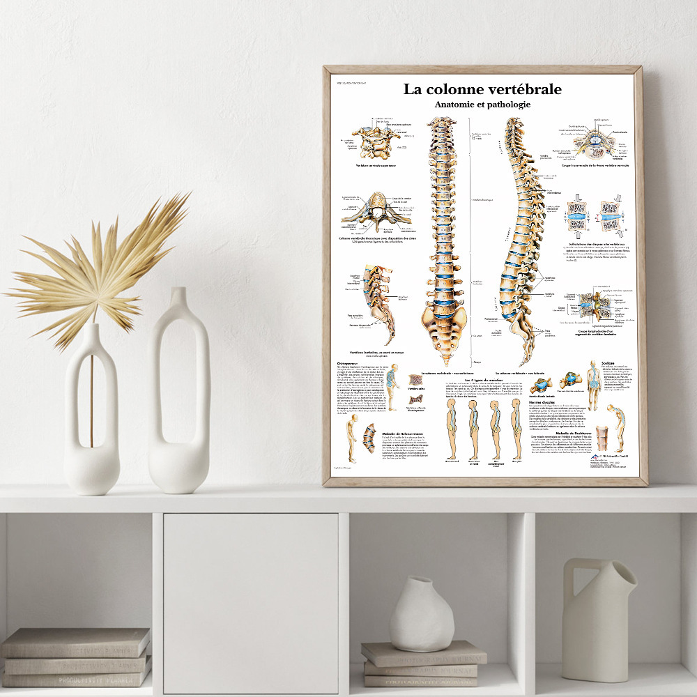 跨境脊椎脊柱解剖分析图人体医学帆布画医院诊所背景墙面装饰画芯
