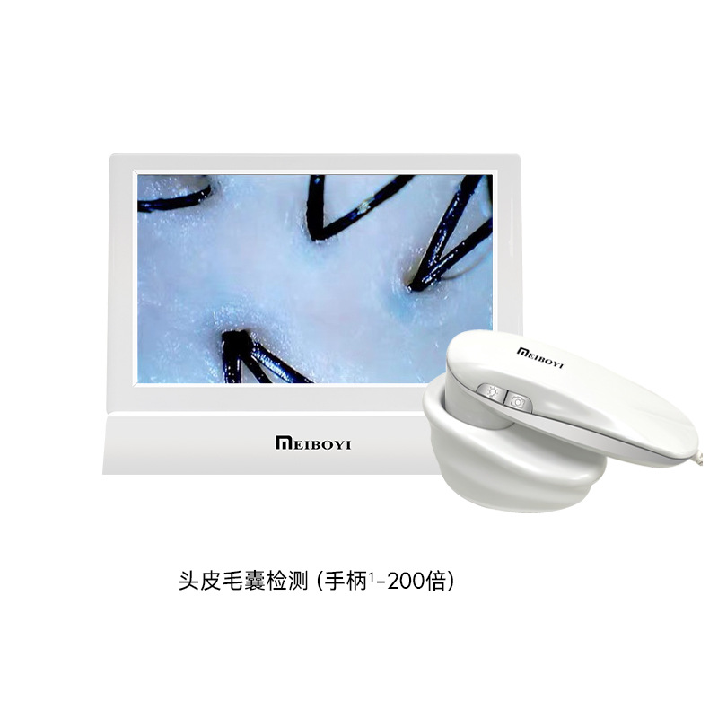 200 배 배율