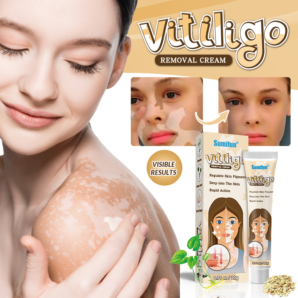 Sumifun Cross-Border AliExpress White Spot Cleanser, crema de cuidado de la piel de manchas de sudor, crema de cuidado de la piel de flores K10073 image 5
