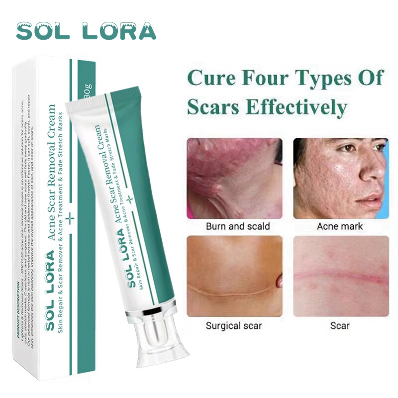 Sol Lora Cross-Border Skin Repair Cream to Reduce Scars