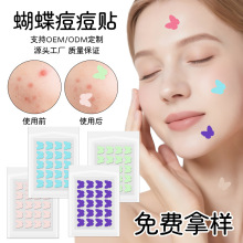 ��ɫ����ˮ�z�w�����N��覸��x�ڶ��N�ɐ����β�ɫ�����N���R�d