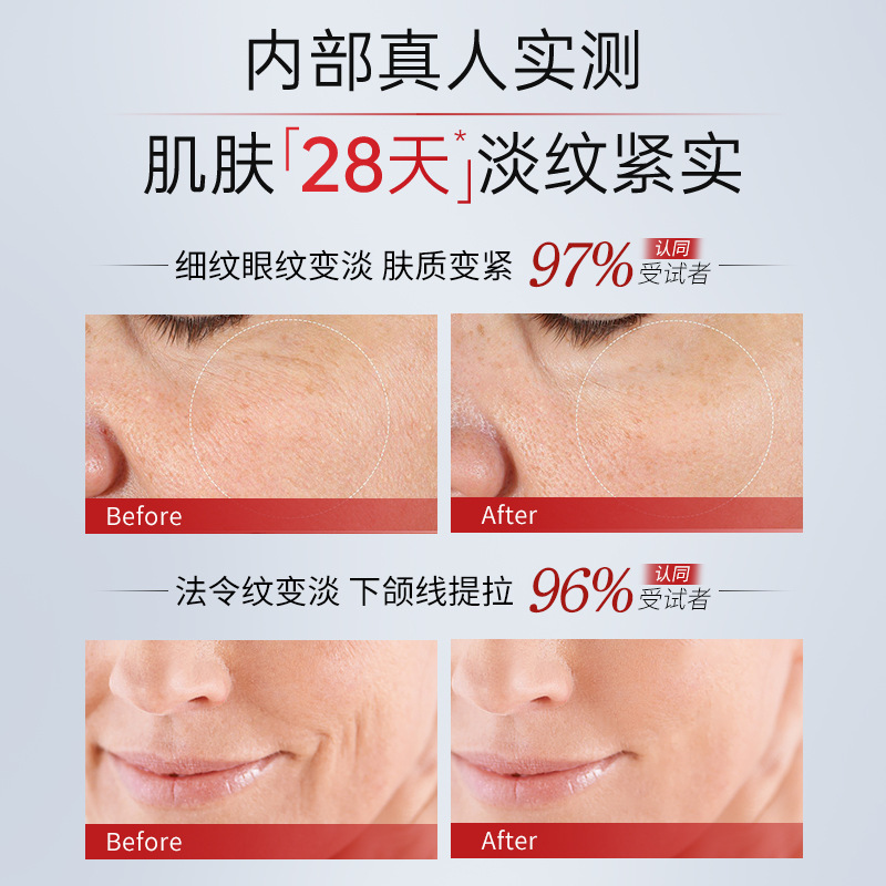 Beilingmei six-peptide antiarrugas Agua Crema Ligera Hidratante hidratante se desvanecen líneas finas elevación reafirmante brillo crema de color de la piel