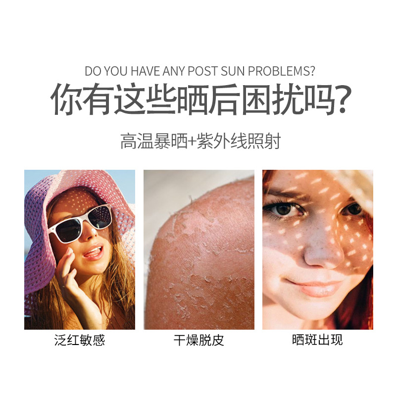 曬傷修復保健乳  曬後修復改善曬傷泛紅蛻皮防紫外線補水修護