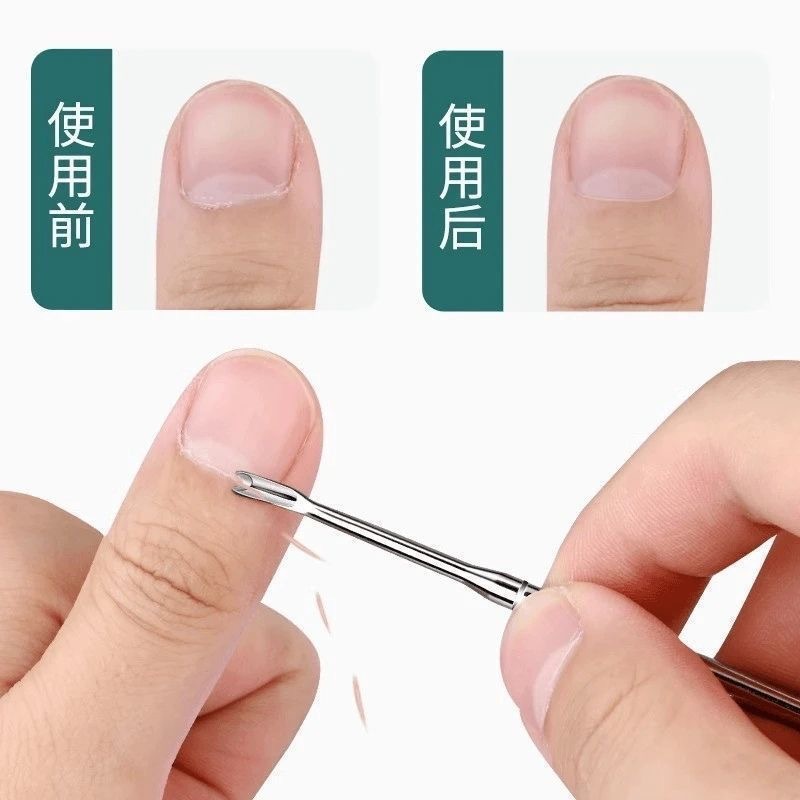 【プロの角質プッシャー】角質除去フォーク、角質除去ナイフプッシャー、手の爪のエッジを整えるための特別なツール、マニキュア|undefined