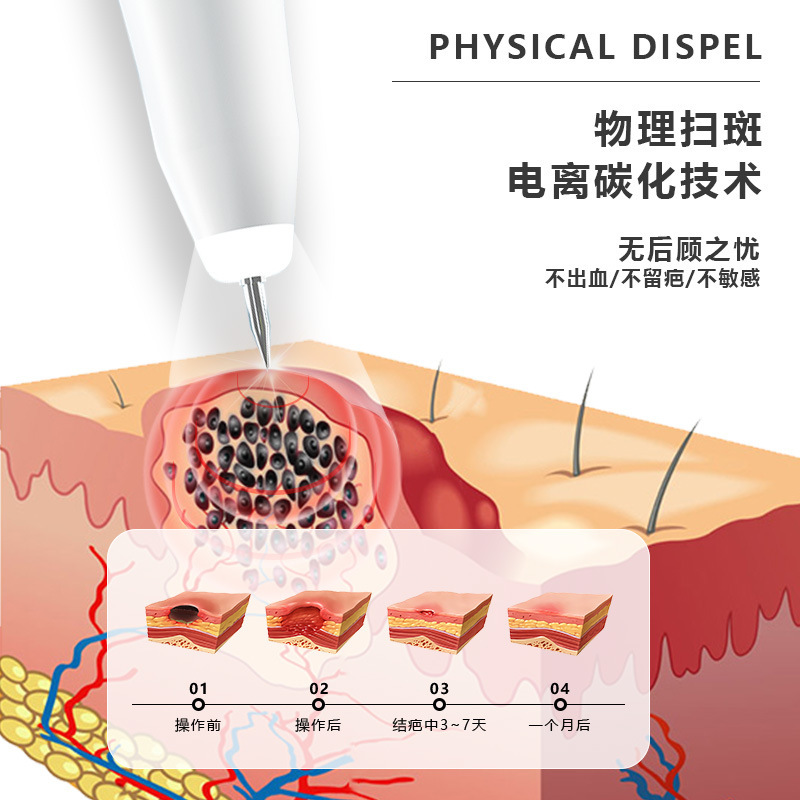 跨境爆款小白点痣笔家用去痣激光扫斑笔美容电离子祛斑仪小白点痣|undefined
