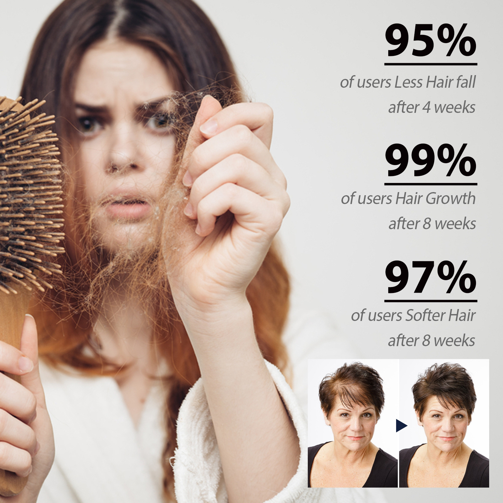 EELHOE Bieziem matiem ampula Spēcīga matu atjaunošana Pret matu izkrišanu Sakņu stiprināšana Biezu matu kopšana Galvas ādas masāža_voghion.com