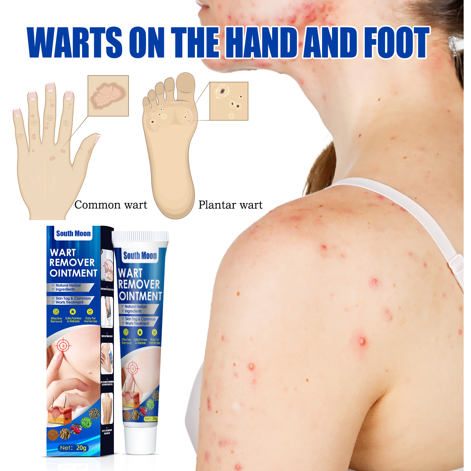 South Moon Wart Pink Warzencreme wird zur Linderung von Warzen an Händen, Füßen, im Gesicht, in den Achselhöhlen und am Hals verwendet._voghion.com