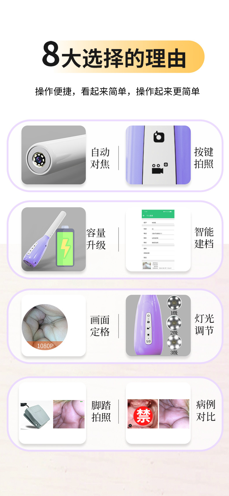 Colposcope endoscope, high resolution, gynecological examination, handheld