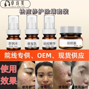 ����AҺˮ����ԭҺ���o������ӡ���ӷ۴��ഺ���ˮ��˪