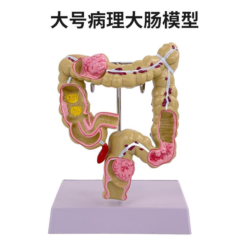 ��ѧ����᳦����ģ�ʹ�ֱ������걾����ҽ����ͨ�������ٽ���