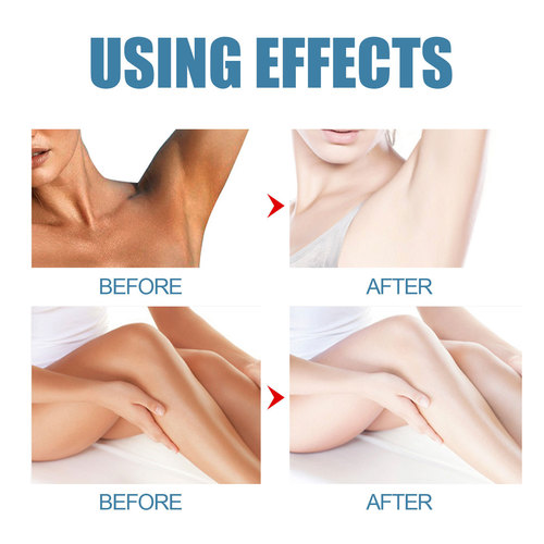 EELHOE Underarm Beauty Cream Underarm Cream Brightening Moisturizing Moisturizing Beauty Cream Body Milk Concealer