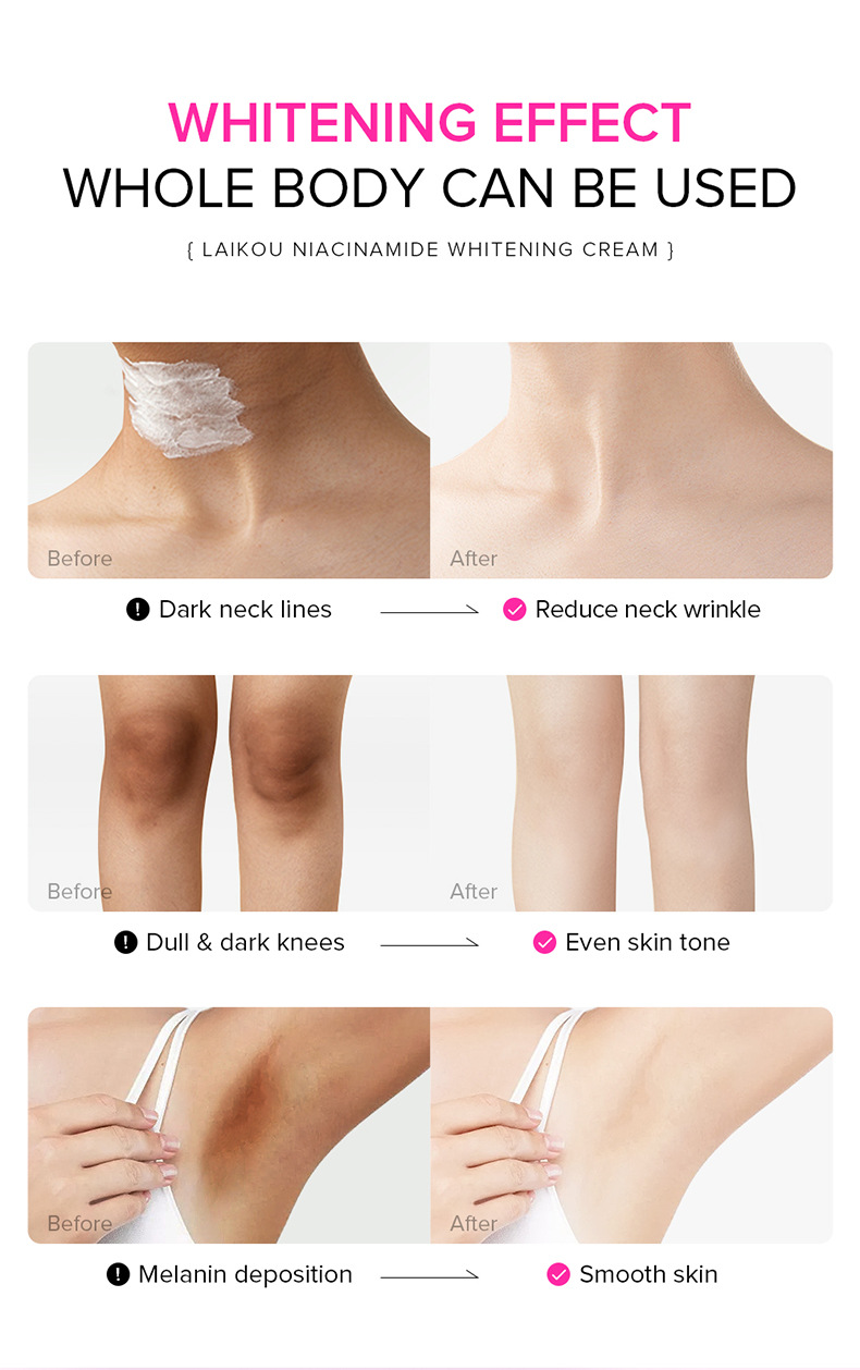 LAIKOU cream 100g Hydrating and moisturizing Underarm Cream Facial skin care products cross-border undefined