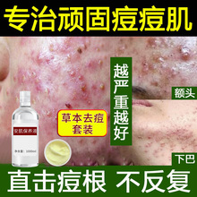 草本祛痘控油精华套装粉刺淡化痘坑痘印水光精华修复敏感肌退红