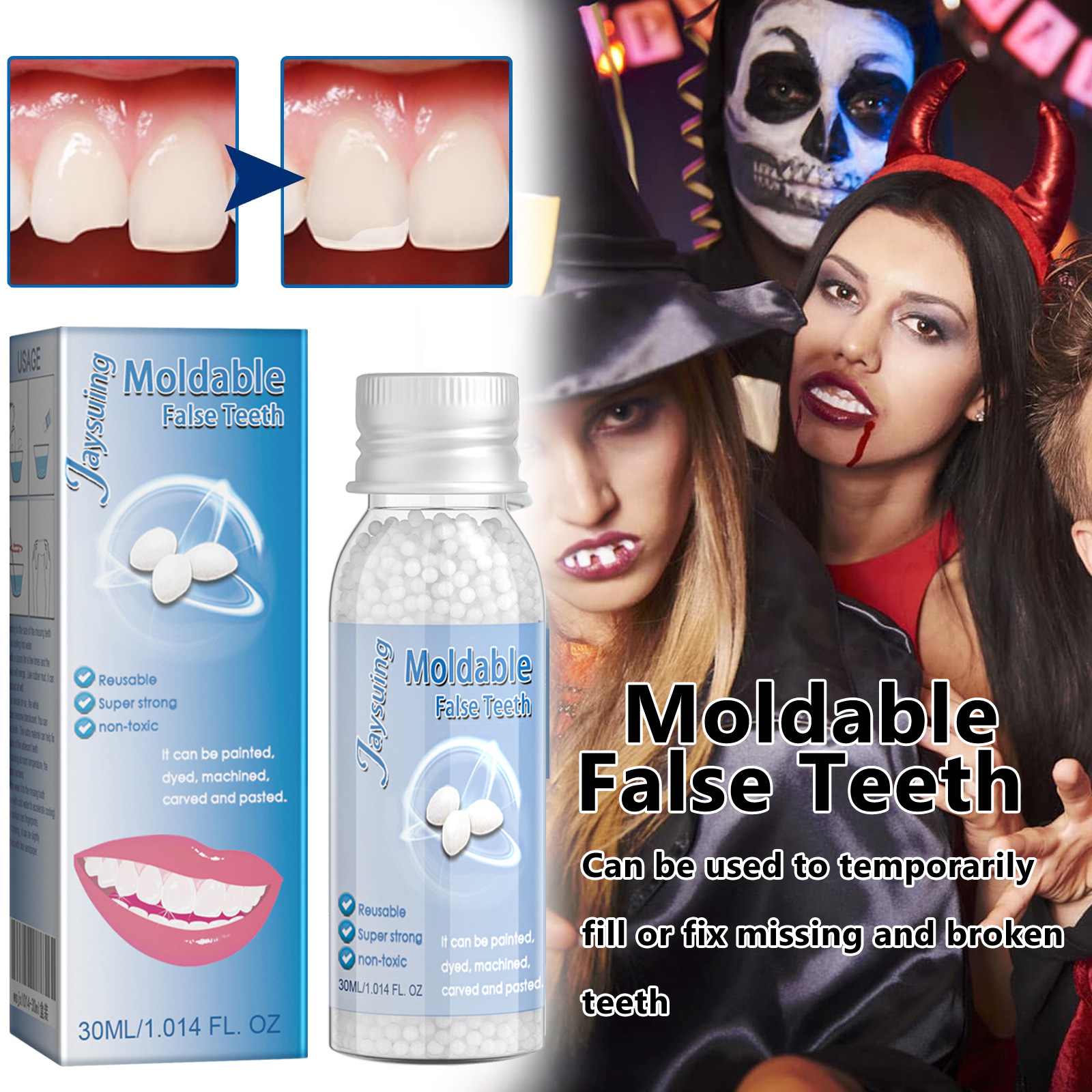 Jaysuing Moldable Dental Glue for Temporary Restoration of Tooth Cavities, Broken Teeth, and Filling Gaps between Teeth