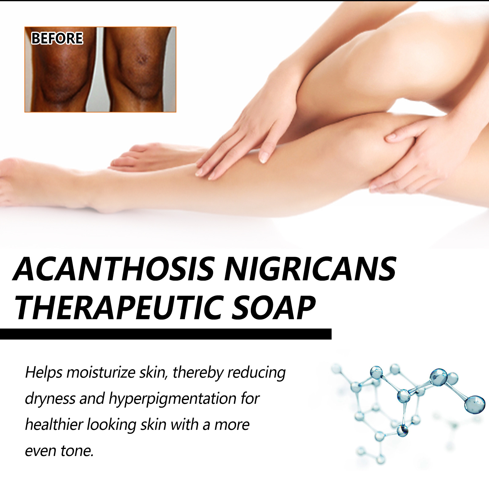 „Jaysuing“ rankų darbo bambuko anglies muilas kūno valymui ir melanino nuosėdų gėlinimui pažastyse_voghion.com