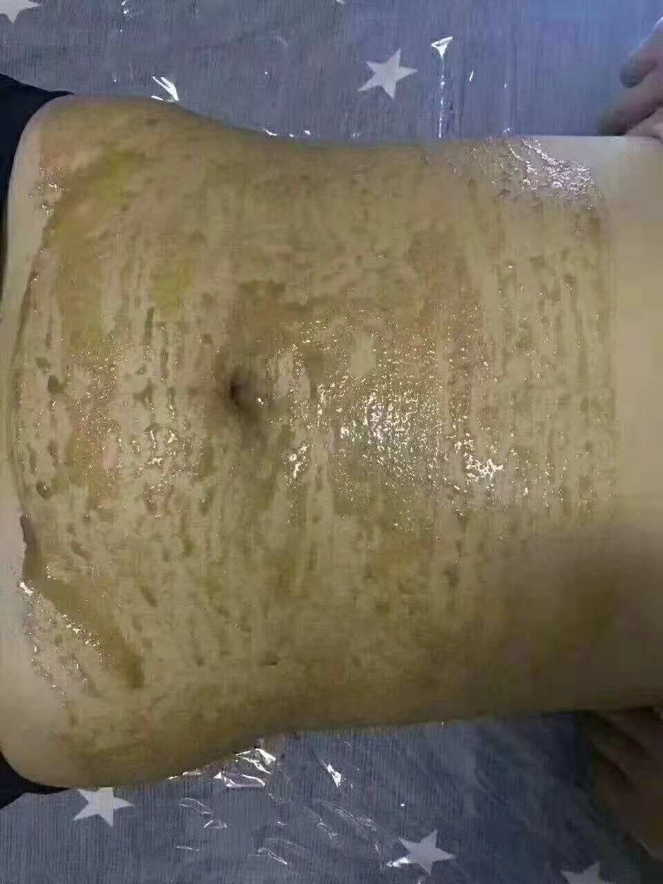 详情图