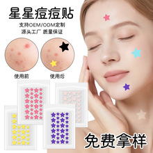 ��ɫ����ˮ�z�w�����N��覸��x�ڶ��N�ɐ����β�ɫ�N���R�d�����N