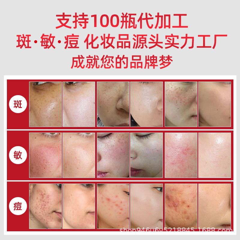 【工場直販そばかすクリーム】抽出不要、恥ずかしくないそばかすクリーム、そばかす、シミ、エステサロン限定|undefined