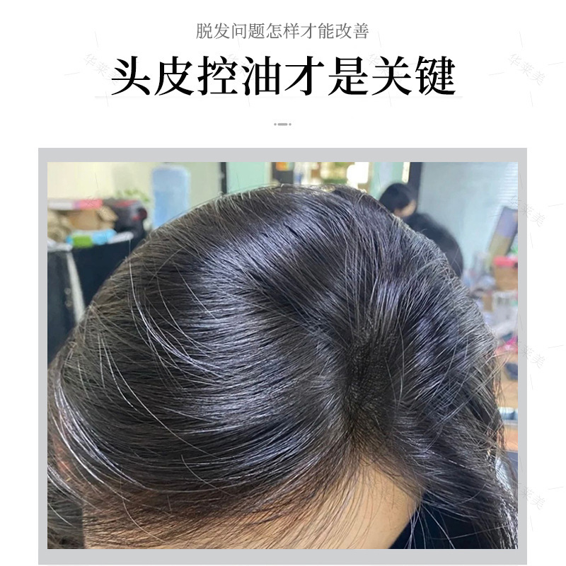 頭皮コントロールオイル凍結防止パウダー頭皮清潔コントロールオイルさわやか頭皮ケア液美容院美容用品バッチ|undefined